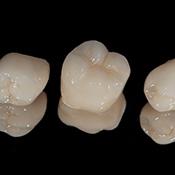 realistic CEREC same-day dental crowns with black background