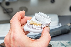 a dental bridge on a mold of a patient’s teeth