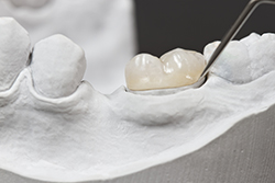 dental crown on model