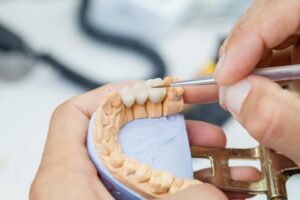 a dental bridge on a mold of teeth being crafted